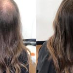 When Your Hair Changes, It Feels Deeper Than Just Looks