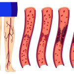 Clearer Skin and Greater Confidence with Modern Thread Vein Treatments