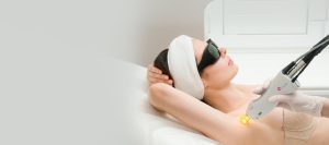 laser hair removal treatment